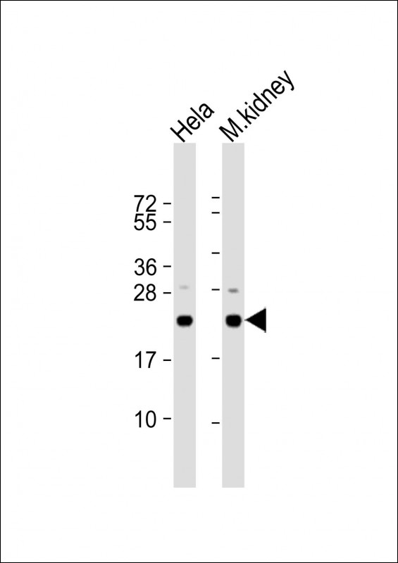 WB - DJ-1 Antibody (N-term) AP6407a